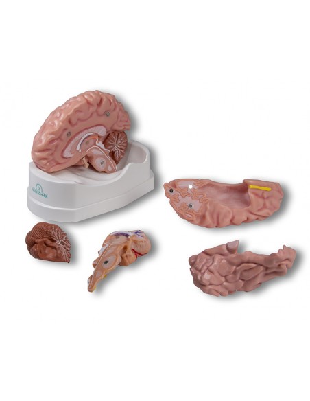 Encefal -din 5 parti- cu detalii