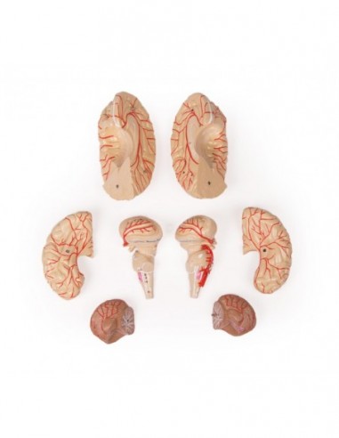 Mulaj creier cu artere